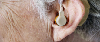 Какие бывают слуховые аппараты и как их выбрать